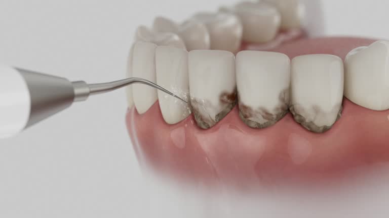Trusted Teeth Whitening service in Luckey, OH - Dentist Open Now